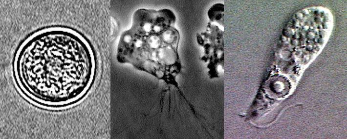 Microscope image of Naegleria fowleri showing its cyst, amoeboid, and flagellate stages